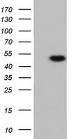 RNH1 Antibody - HEK293T cells were transfected with the pCMV6-ENTRY control (Left lane) or pCMV6-ENTRY RNH1 (Right lane) cDNA for 48 hrs and lysed. Equivalent amounts of cell lysates (5 ug per lane) were separated by SDS-PAGE and immunoblotted with anti-RNH1.