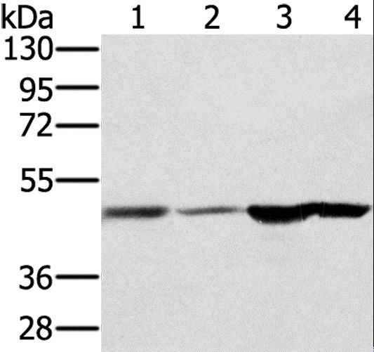 RNH1 Antibody - Western blot analysis of Human fetal brain and normal liver tissue, human normal kidney tissue and hepg2 cell, using RNH1 Polyclonal Antibody at dilution of 1:400.