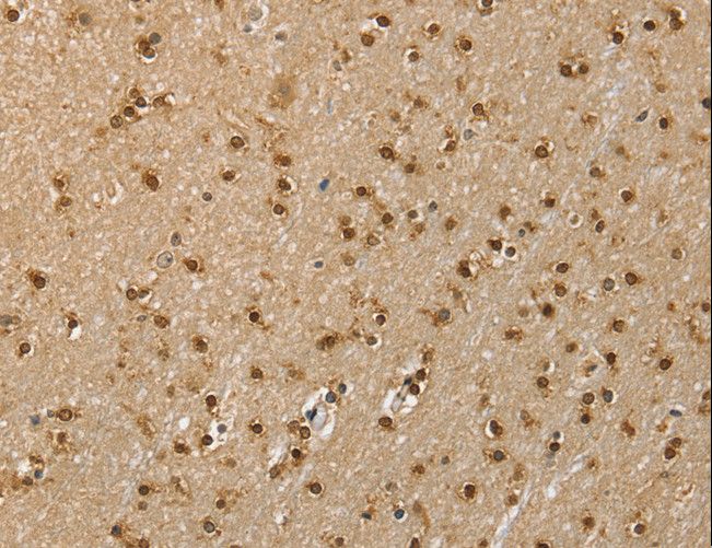 RNH1 Antibody - Immunohistochemistry of paraffin-embedded Human brain using RNH1 Polyclonal Antibody at dilution of 1:40.