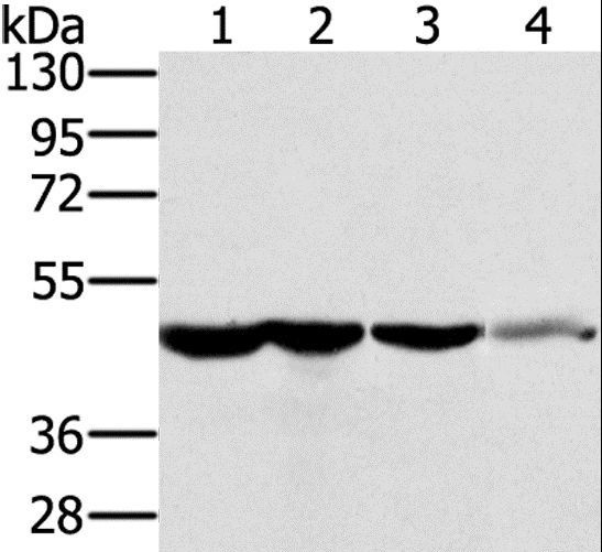 RNH1 Antibody - Western blot analysis of HT-29 cell and human normal kidney tissue, Lo2 cell and human normal liver tissue, human fetal brain tissue, using RNH1 Polyclonal Antibody at dilution of 1:400.