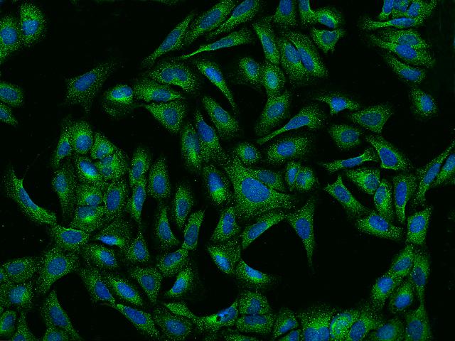 RNH1 Antibody - Immunofluorescence staining of RNH1 in U2OS cells. Cells were fixed with 4% PFA, permeabilzed with 0.1% Triton X-100 in PBS, blocked with 10% serum, and incubated with rabbit anti-human RNH1 polyclonal antibody (dilution ratio 1:1000) at 4°C overnight. Then cells were stained with the Alexa Fluor 488-conjugated Goat Anti-rabbit IgG secondary antibody (green) and counterstained with DAPI (blue). Positive staining was localized to Cytoplasm.