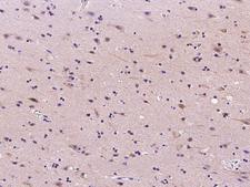 RNH1 Antibody - Immunochemical staining of human RNH1 in human brain with rabbit polyclonal antibody at 1:2000 dilution, formalin-fixed paraffin embedded sections.