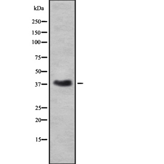 RNLS / Renalase Antibody - Western blot analysis of RNLS using A549 whole cells lysates