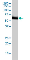 RNMT / HCM Antibody - RNMT monoclonal antibody (M01), clone 3H3-1D12 Western blot of RNMT expression in HeLa.