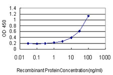 RNMT / HCM Antibody - Detection limit for recombinant GST tagged RNMT is approximately 1 ng/ml as a capture antibody.
