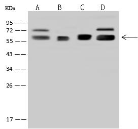 RNMT / HCM Antibody - Anti-RNMT rabbit polyclonal antibody at 1:500 dilution. Lane A: Hela Whole Cell Lysate. Lane B: HEK-293 Whole Cell Lysate. Lane C: 293T Whole Cell Lysate. Lane D: Jurkat Whole Cell Lysate. Lysates/proteins at 30 ug per lane. Secondary: Goat Anti-Rabbit IgG (H+L)/HRP at 1/10000 dilution. Developed using the ECL technique. Performed under reducing conditions. Predicted band size: 55 kDa. Observed band size: 57 kDa.