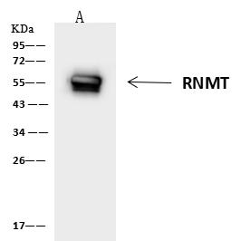 RNMT / HCM Antibody - RNMT was immunoprecipitated using: Lane A: 0.5 mg Jurkat Whole Cell Lysate. 4 uL anti-RNMT rabbit polyclonal antibody and 60 ug of Immunomagnetic beads Protein A/G. Primary antibody: Anti-RNMT rabbit polyclonal antibody, at 1:100 dilution. Secondary antibody: Goat Anti-Rabbit IgG (H+L)/HRP at 1/10000 dilution. Developed using the ECL technique. Performed under reducing conditions. Predicted band size: 55 kDa. Observed band size: 60 kDa.