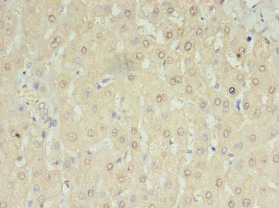 RNMTL1 Antibody - Immunohistochemistry of paraffin-embedded human liver tissue using antibody at dilution of 1:100.