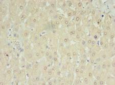 RNMTL1 Antibody - Immunohistochemistry of paraffin-embedded human liver tissue using antibody at dilution of 1:100.