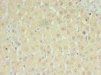 RNMTL1 Antibody - Immunohistochemistry of paraffin-embedded human liver tissue using MRM3 Antibody at dilution of 1:100
