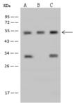 RNMTL1 Antibody - Anti-RNMTL1 rabbit polyclonal antibody at 1:500 dilution. Lane A: U87MG Whole Cell Lysate. Lane B: HepG2 Whole Cell Lysate. Lane C: 293T Whole Cell Lysate. Lysates/proteins at 30 ug per lane. Secondary: Goat Anti-Rabbit IgG (H+L)/HRP at 1/10000 dilution. Developed using the ECL technique. Performed under reducing conditions. Predicted band size: 47 kDa. Observed band size: 54 kDa.