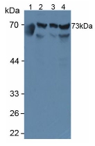 RNPEP Antibody - Western Blot; Sample: Lane1: Human Serum; Lane2: Human Hela Cells; Lane3: Human A549 Cells; Lane4: Human HepG2 Cells.