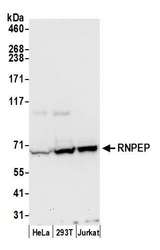 RNPEP Antibody - Detection of human RNPEP by western blot. Samples: Whole cell lysate (50 µg) from HeLa, HEK293T, and Jurkat cells prepared using NETN lysis buffer. Antibody: Affinity purified rabbit anti-RNPEP antibody used for WB at 1:1000. Detection: Chemiluminescence with an exposure time of 30 seconds.