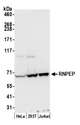 RNPEP Antibody - Detection of human RNPEP by western blot. Samples: Whole cell lysate (50 µg) from HeLa, HEK293T, and Jurkat cells prepared using NETN lysis buffer. Antibody: Affinity purified rabbit anti-RNPEP antibody used for WB at 1:1000. Detection: Chemiluminescence with an exposure time of 30 seconds.