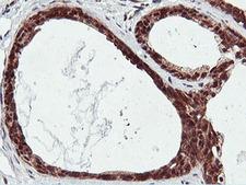 RNPEP Antibody - IHC of paraffin-embedded Human breast tissue using anti-RNPEP mouse monoclonal antibody.