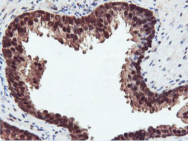 RNPEP Antibody - IHC of paraffin-embedded Human prostate tissue using anti-RNPEP mouse monoclonal antibody.