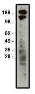ROBO1 Antibody - Western blot of ROBO1 antibody on HT-29 cell lysate. Lysate used at 30 ug/lane. Antibody used at 1:400 dilution. Secondary antibody, mouse anti-rabbit HRP, used at 1:50k dilution.