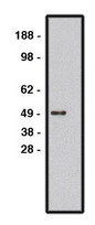 ROBO1 Antibody - Western blot of ROBO1 antibody on human brain lysate. Lysate used at 15 ug/lane. Antibody used at 10 ug/ml. Secondary antibody, mouse anti-rabbit HRP, used at 1:50k.
