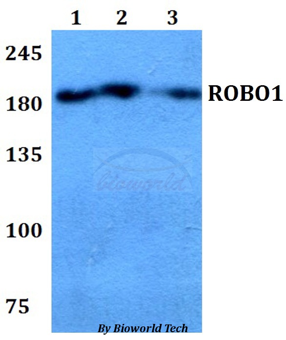 ROBO1 Antibody - Western blot of ROBO1 antibody at 1:500 dilution. Lane 1: HEK293T whole cell lysate. Lane 2: Raw264.7 whole cell lysate. Lane 3: PC12 whole cell lysate.