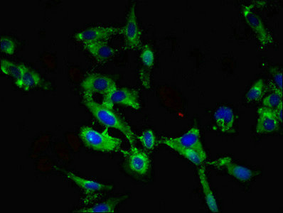 ROBO1 Antibody - Immunofluorescent analysis of Hela cells using ROBO1 Antibody at dilution of 1:100 and Alexa Fluor 488-congugated AffiniPure Goat Anti-Rabbit IgG(H+L)