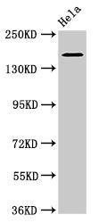 ROBO1 Antibody - Western Blot Positive WB detected in: Hela whole cell lysate All lanes: ROBO1 antibody at 3.2µg/ml Secondary Goat polyclonal to rabbit IgG at 1/50000 dilution Predicted band size: 181, 182, 177, 176, 170 kDa Observed band size: 181 kDa