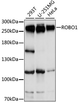 ROBO1 Antibody - Western blot analysis of extracts of various cell lines, using ROBO1 antibody at 1:1000 dilution. The secondary antibody used was an HRP Goat Anti-Rabbit IgG (H+L) at 1:10000 dilution. Lysates were loaded 25ug per lane and 3% nonfat dry milk in TBST was used for blocking. An ECL Kit was used for detection and the exposure time was 3s.