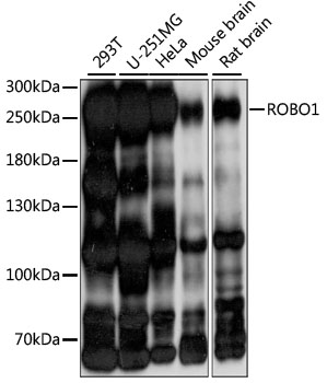ROBO1 Antibody - Western blot analysis of extracts of various cell lines, using ROBO1 antibody at 1:1000 dilution. The secondary antibody used was an HRP Goat Anti-Rabbit IgG (H+L) at 1:10000 dilution. Lysates were loaded 25ug per lane and 3% nonfat dry milk in TBST was used for blocking. An ECL Kit was used for detection and the exposure time was 10s.