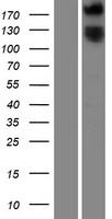 ROBO1 Protein - Western validation with an anti-DDK antibody * L: Control HEK293 lysate R: Over-expression lysate