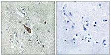 ROBO2 Antibody - Immunohistochemistry analysis of paraffin-embedded human brain tissue, using ROBO2 Antibody. The picture on the right is blocked with the synthesized peptide.