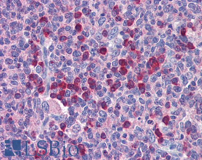 ROBO2 Antibody - Anti-ROBO2 antibody IHC of human tonsil. Immunohistochemistry of formalin-fixed, paraffin-embedded tissue after heat-induced antigen retrieval. Antibody concentration 5 ug/ml.  This image was taken for the unconjugated form of this product. Other forms have not been tested.