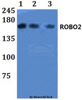 ROBO2 Antibody - Western blot of ROBO2 antibody at 1:500 dilution. Lane 1: HEK293T whole cell lysate. Lane 2: Raw264.7 whole cell lysate. Lane 3: H9C2 whole cell lysate.