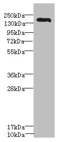 ROBO2 Antibody - Western blot All Lanes: ROBO2 antibody IgG at 1.43ug/ml+ Mouse liver tissue Secondary Goat polyclonal to rabbit IgG at 1/10000 dilution Predicted band size: 152,131,154 kDa Observed band size: 151 kDa
