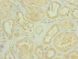 ROBO2 Antibody - Immunohistochemistry of paraffin-embedded human kidney tissue at dilution 1:100