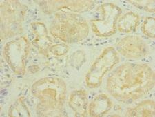 ROBO2 Antibody - Immunohistochemistry of paraffin-embedded human kidney tissue at dilution 1:100