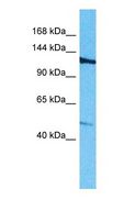 ROBO3 Antibody - Western blot of ROBO3 Antibody with human Jurkat Whole Cell lysate.  This image was taken for the unconjugated form of this product. Other forms have not been tested.