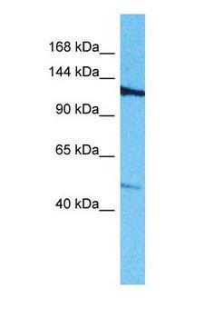 ROBO3 Antibody - Western blot of ROBO3 Antibody with human Jurkat Whole Cell lysate.  This image was taken for the unconjugated form of this product. Other forms have not been tested.
