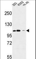 ROBO4 Antibody - Roundabout 4 Antibody western blot of 293,K562,HL-60 cell line lysates (35 ug/lane). The Roundabout4 antibody detected the Roundabout4 protein (arrow).