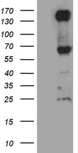 ROBO4 Antibody - HEK293T cells were transfected with the pCMV6-ENTRY control. (Left lane) or pCMV6-ENTRY ROBO4. (Right lane) cDNA for 48 hrs and lysed. Equivalent amounts of cell lysates. (5 ug per lane) were separated by SDS-PAGE and immunoblotted with anti-ROBO4. (1:2000)