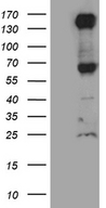 ROBO4 Antibody - HEK293T cells were transfected with the pCMV6-ENTRY control. (Left lane) or pCMV6-ENTRY ROBO4. (Right lane) cDNA for 48 hrs and lysed
