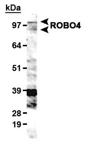 ROBO4 Antibody - Detection of ROBO4 in HUVEC cell lysates with ROBO4 Antibody. This image was taken for the unconjugated form of this product. Other forms have not been tested.