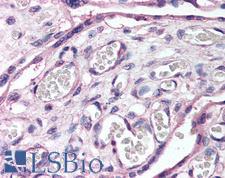 ROBO4 Antibody - Anti-ROBO4 antibody IHC of human placenta. Immunohistochemistry of formalin-fixed, paraffin-embedded tissue after heat-induced antigen retrieval. Antibody concentration 5 ug/ml.  This image was taken for the unconjugated form of this product. Other forms have not been tested.