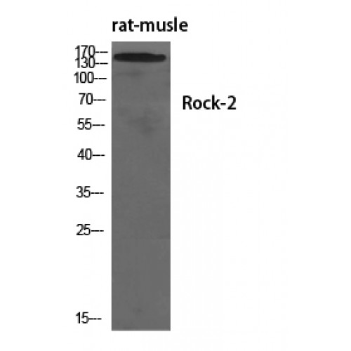 ROCK2 Antibody - Western blot of Rock-2 antibody