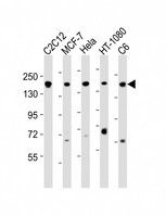 ROCK2 Antibody - All lanes : Anti-ROCK2 Antibody at 1:2000 dilution Lane 1: C2C12 whole cell lysates Lane 2: MCF-7 whole cell lysates Lane 3: HeLa whole cell lysates Lane 4: HT-1080 whole cell lysates Lane 5: C6 whole cell lysates Lysates/proteins at 20 ug per lane. Secondary Goat Anti-Rabbit IgG, (H+L), Peroxidase conjugated at 1/10000 dilution Predicted band size : 161 kDa Blocking/Dilution buffer: 5% NFDM/TBST.