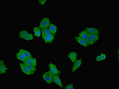 ROCK2 Antibody - Immunofluorescent analysis of HepG2 cells using ROCK2 Antibody at dilution of 1:100 and Alexa Fluor 488-congugated AffiniPure Goat Anti-Rabbit IgG(H+L)