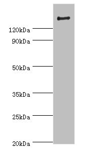 ROCK2 Antibody - Western blot All lanes: ROCK2 antibody at 2µg/ml + Rat brain tissue Secondary Goat polyclonal to rabbit IgG at 1/10000 dilution Predicted band size: 161 kDa Observed band size: 161 kDa