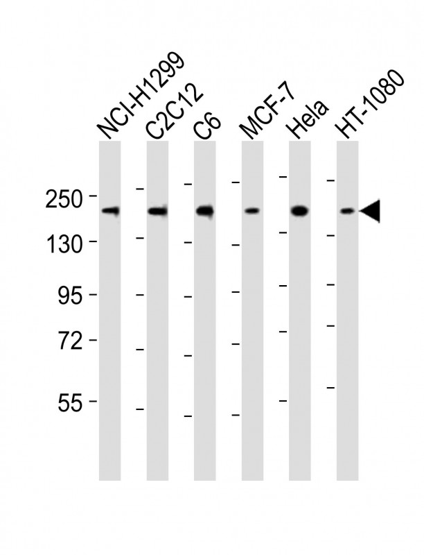 ROCK2 Antibody - All lanes : Anti-ROCK2 Antibody at 1:2000 dilution Lane 1: NCI-H1299 whole cell lysates Lane 2: C2C12 whole cell lysates Lane 3: C6 whole cell lysates Lane 4: MCF-7 whole cell lysates Lane 5: HeLa whole cell lysates Lane 6: HT-1080 whole cell lysates Lysates/proteins at 20 ug per lane. Secondary Goat Anti-Rabbit IgG, (H+L), Peroxidase conjugated at 1/10000 dilution Predicted band size : 161 kDa Blocking/Dilution buffer: 5% NFDM/TBST.