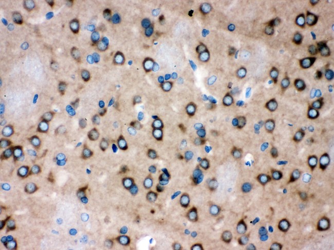 ROCK2 Antibody - ROCK2 antibody IHC-paraffin: Rat Brain Tissue.