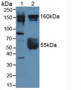 ROCK2 Antibody - Western Blot; Sample: Lane1: Human Liver Tissue; Lane2: Human Serum.