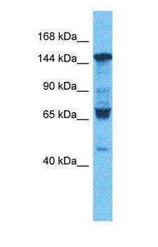 ROCK2 Antibody - Western blot of ROCK2 Antibody with human HeLa Whole Cell lysate.  This image was taken for the unconjugated form of this product. Other forms have not been tested.