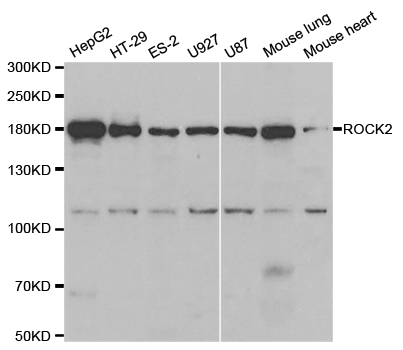 ROCK2 Antibody - Western blot analysis of extracts of various cell lines.